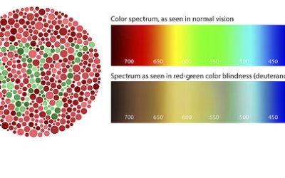 What to Know About Color Blindness