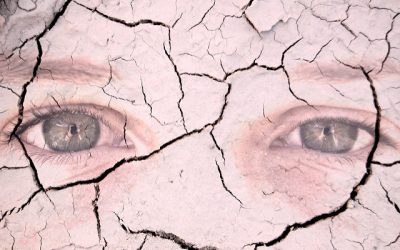 Tips to Alleviate Dry Eyes