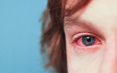 Allergy Management and Your Eyes
