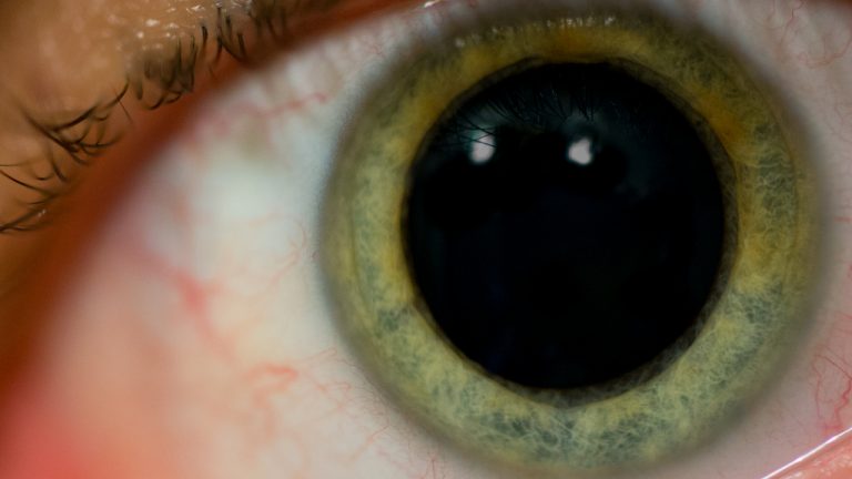 pupil-dilation-a-crucial-part-of-your-comprehensive-eye-exam