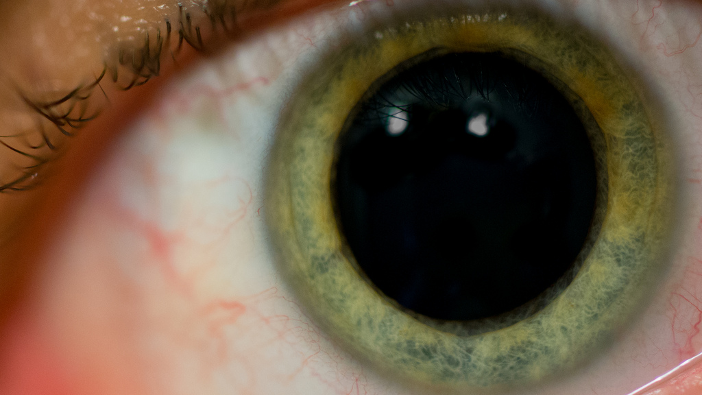What Does Dilating My Eyes Do The Eye Institute