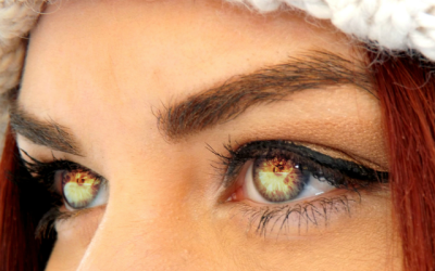 Cosmetic Contact Lenses: Trick or Treat?