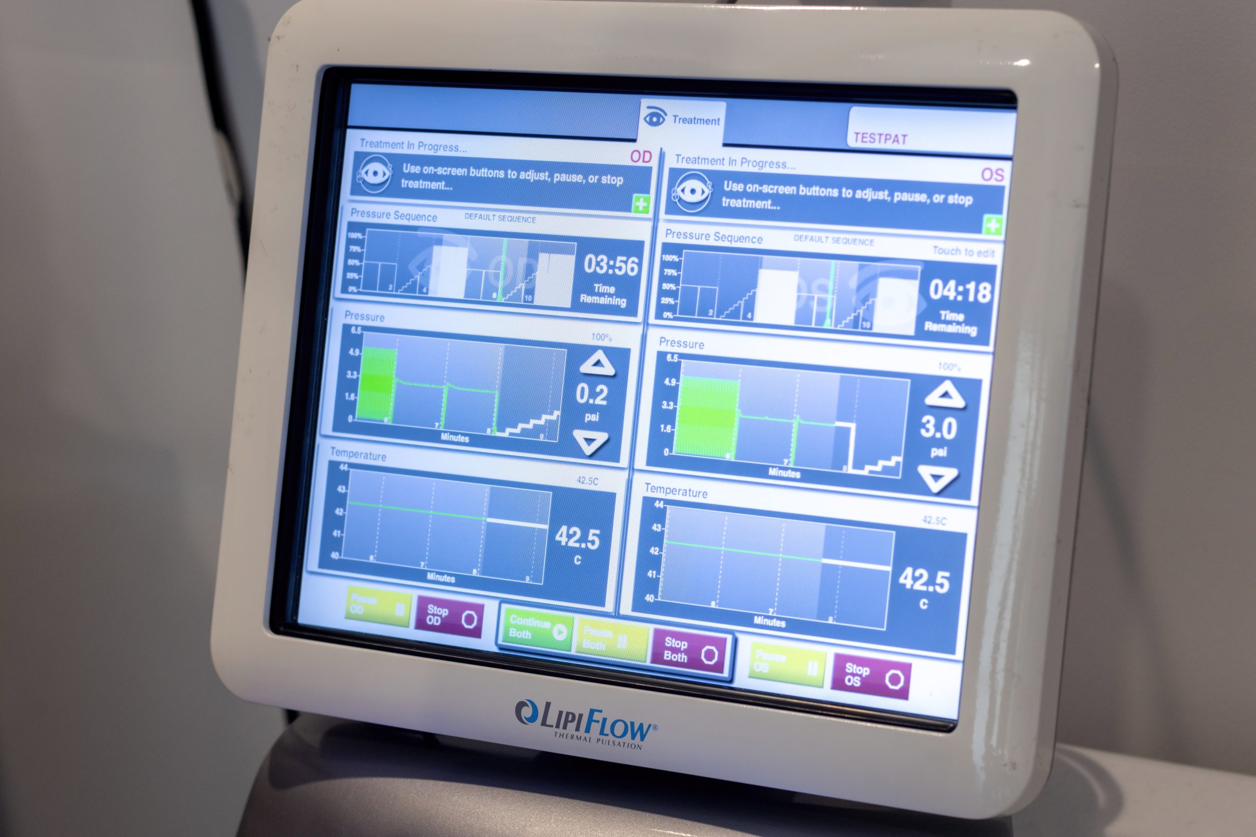 Image screen displaying readings from a LipiFlow procedure. Pressure Sequence, Pressure, and Temperature are all displayed and compared.