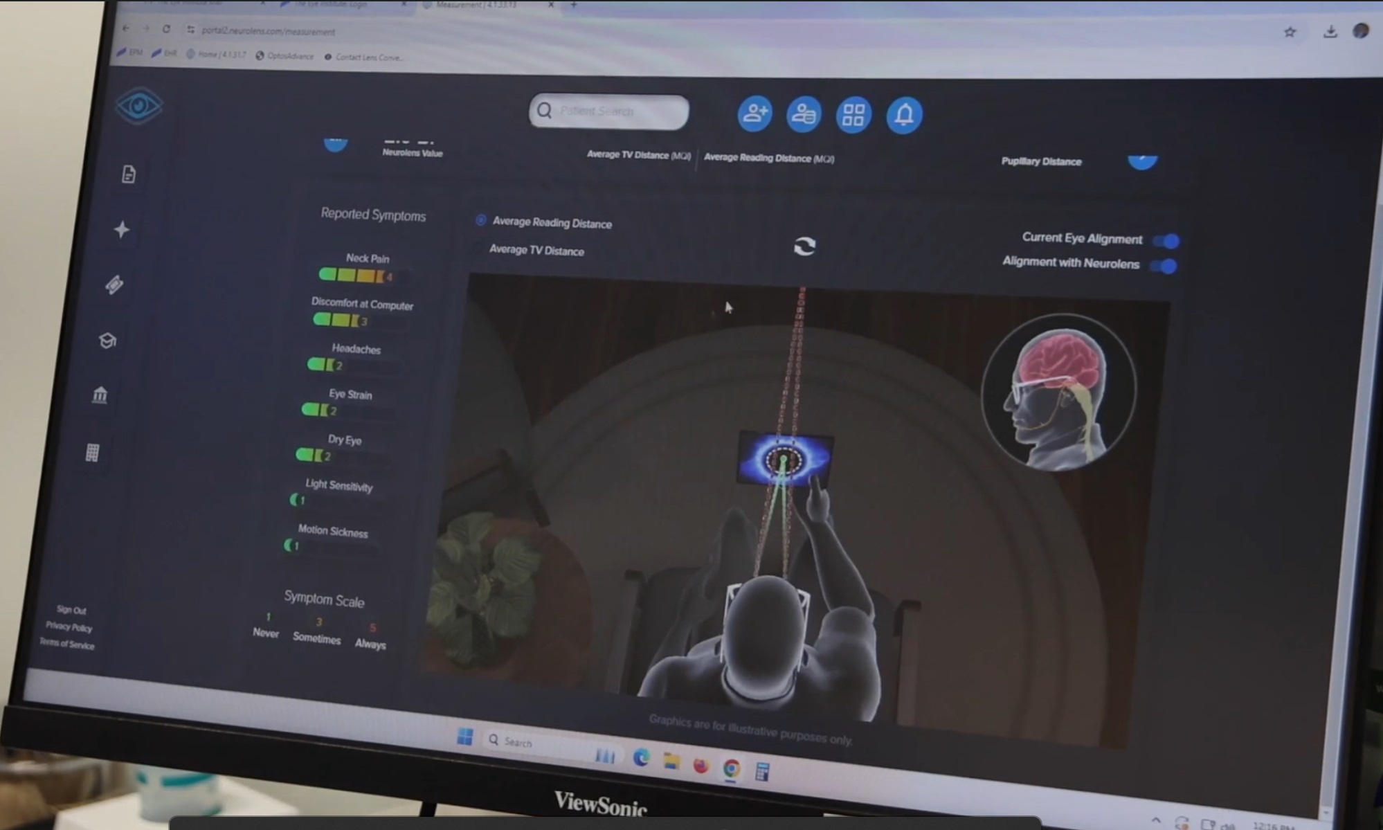 Image of digital screen displaying data associated with the Neurolens procedure. It shows different levels for neck pain, headaches, eye strain, and other common eye ailments. It also contains a graphic of a figure looking at a digital screen, demonstrating Neurolens in action.