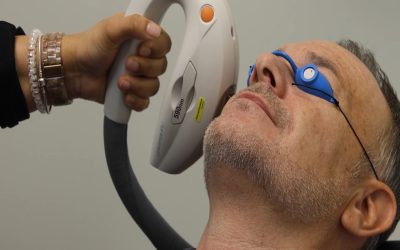 Intense Pulsed Light (IPL) Therapy for Dry Eye Relief